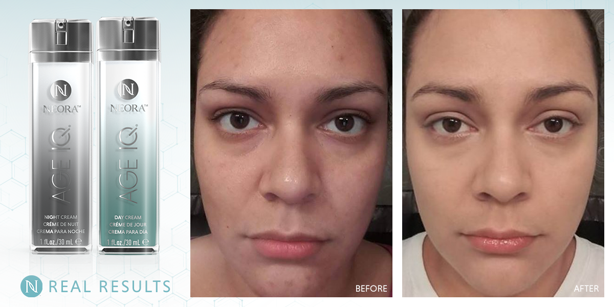 neora age iq night cream